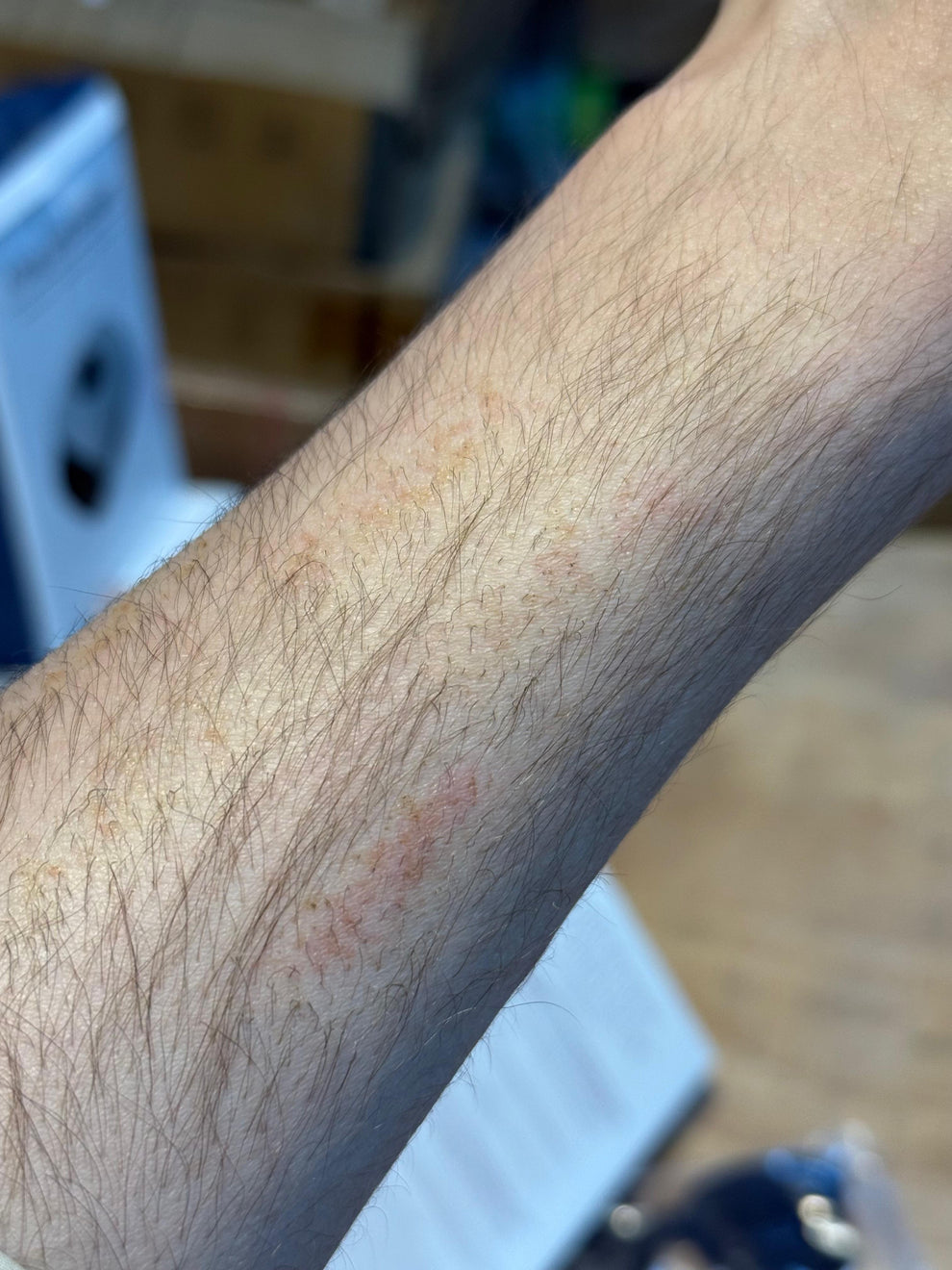 Philips IPL Hair Removal 9900